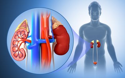 Haemodialysis